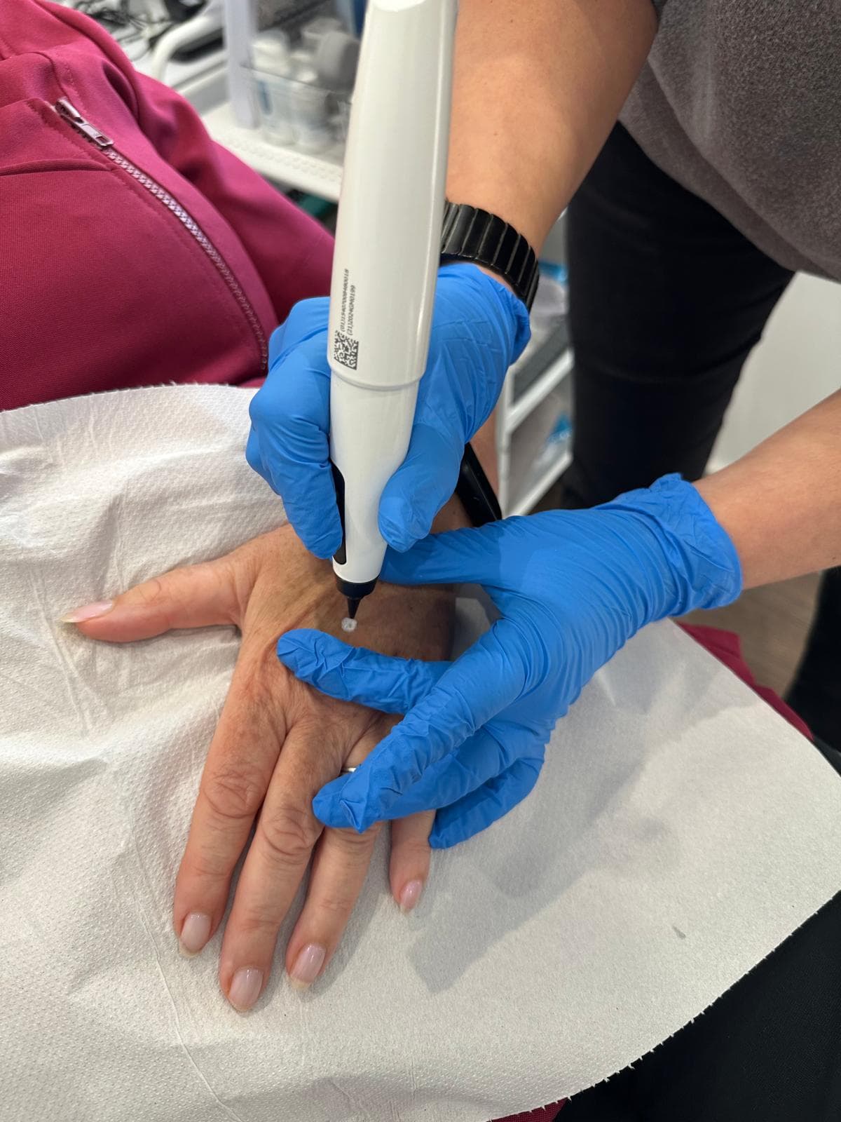 CryoPen at Olive Beauty