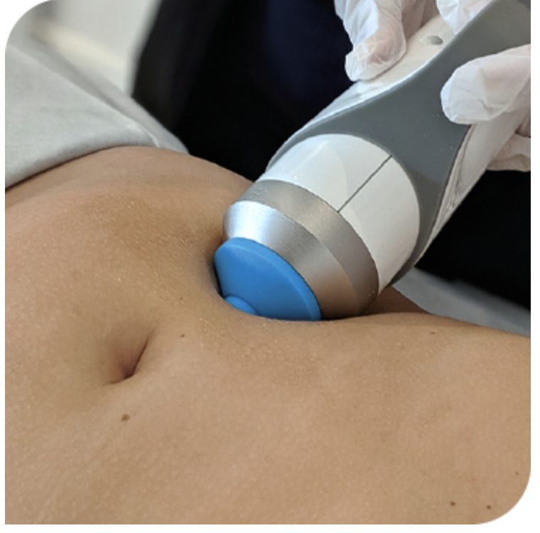 Shockwave Cellulite Reduction Treatment in Action at olive beauty in milton keynes