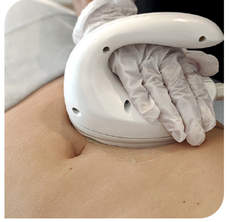 Cavitation Inchloss large hand piece at olive beauty in milton keynes