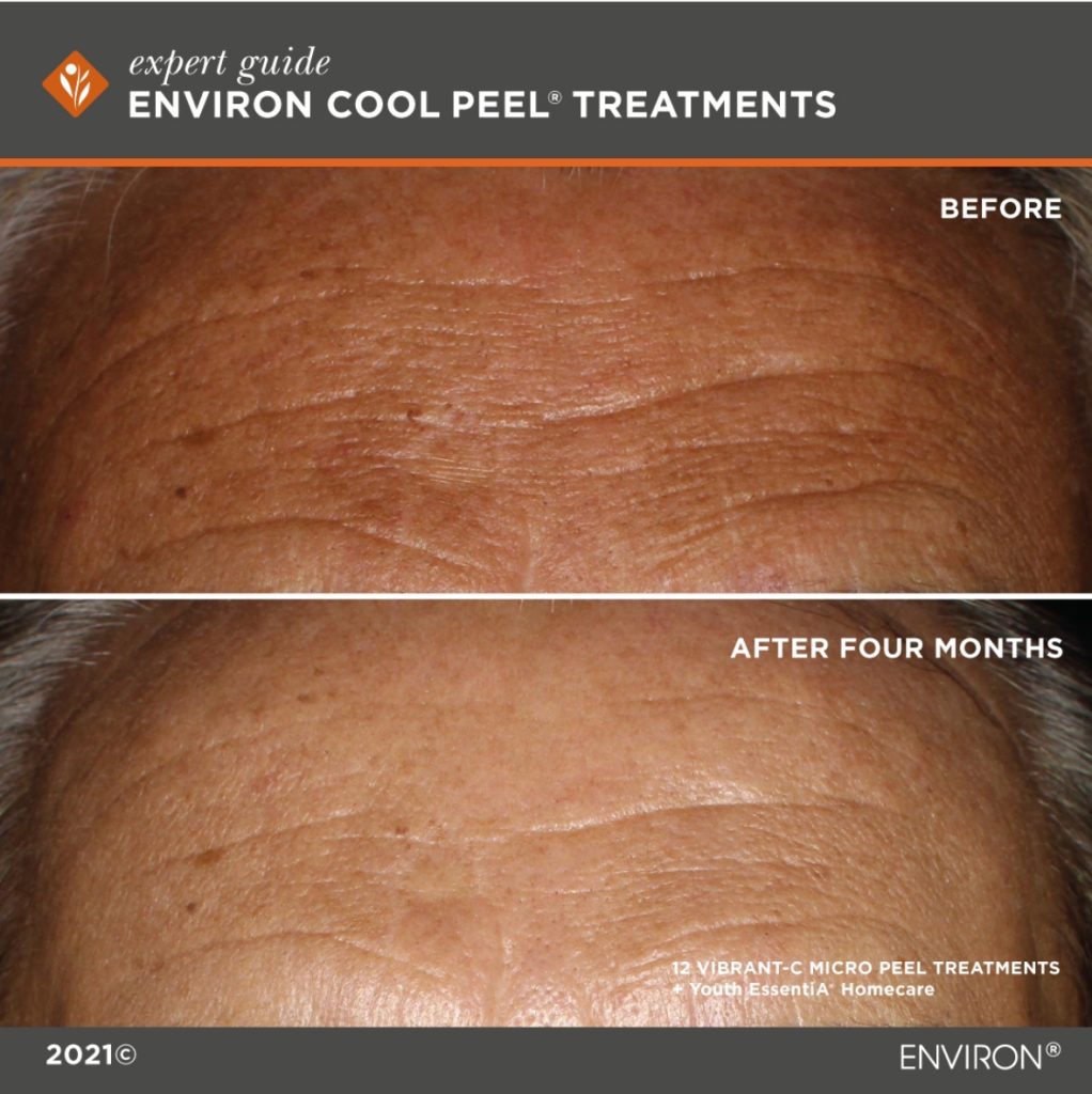 Environ micro-c vitamin c cool peel