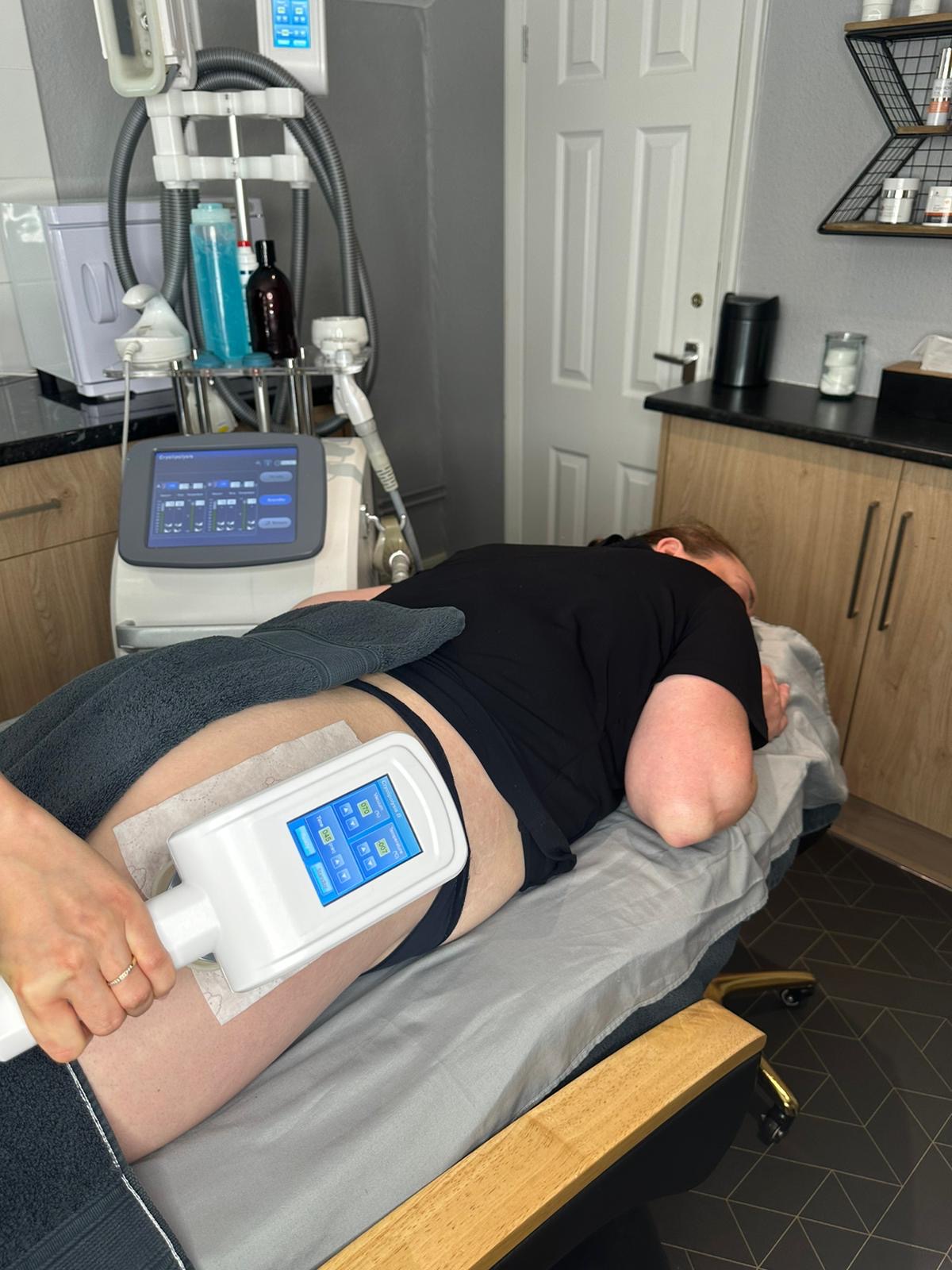 Fat Freezing at olive beauty & aesthetics in milton keynes