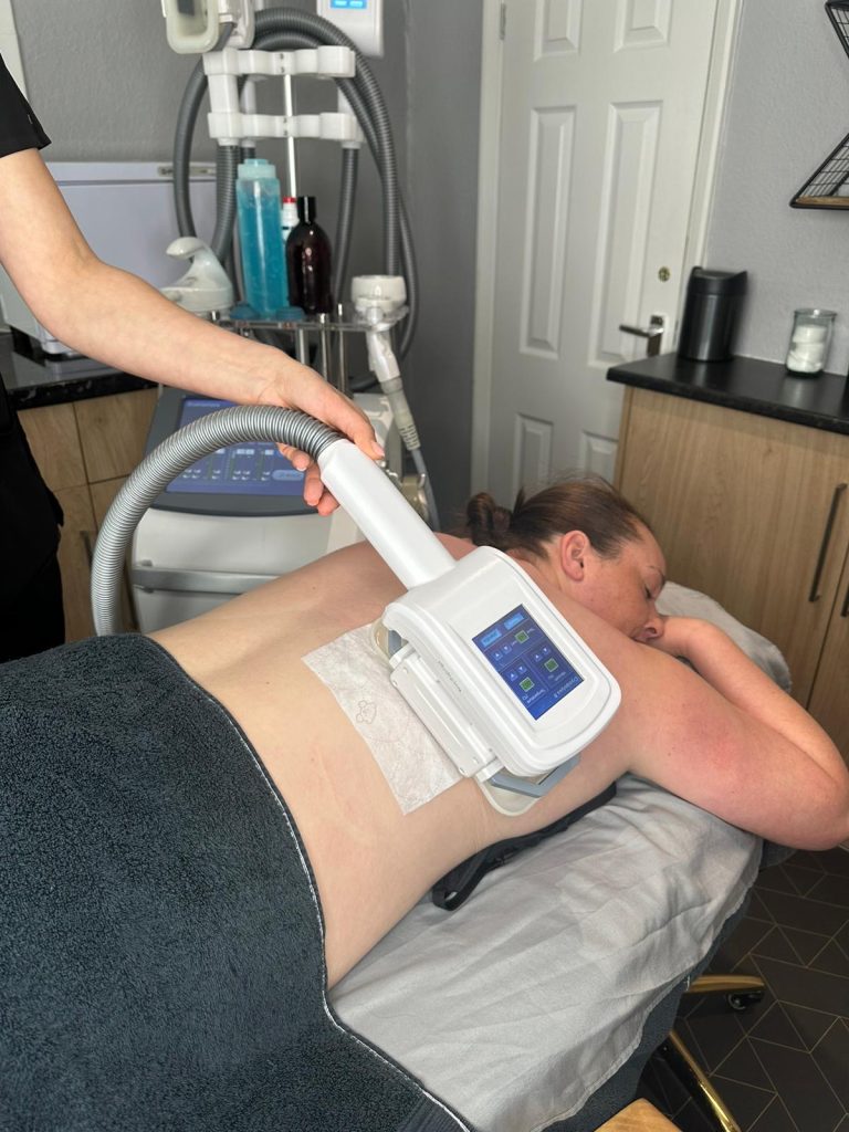 does fat freezing really work? at olive beauty and aesthetics in milton keynes.